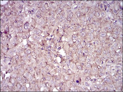 Immunohistochemistry (Formalin/PFA-fixed paraffin-embedded sections) - Anti-CD38 antibody [5C5C3] - Extracellular domain (AB204940)