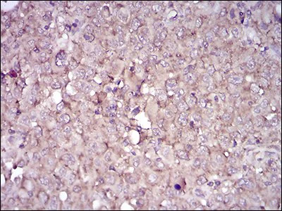 Immunohistochemistry (Formalin/PFA-fixed paraffin-embedded sections) - Anti-CD38 antibody [5C5C3] - Extracellular domain (AB204940)