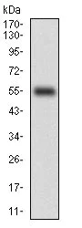 Western blot - Anti-CD38 antibody [5C5C3] - Extracellular domain (AB204940)