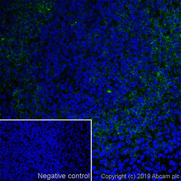 Immunohistochemistry (Frozen sections) - Anti-CD38 antibody [90] (AB61400)