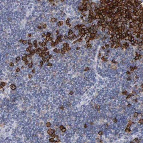Immunohistochemistry (Formalin/PFA-fixed paraffin-embedded sections) - Anti-CD38 antibody (AB244390)