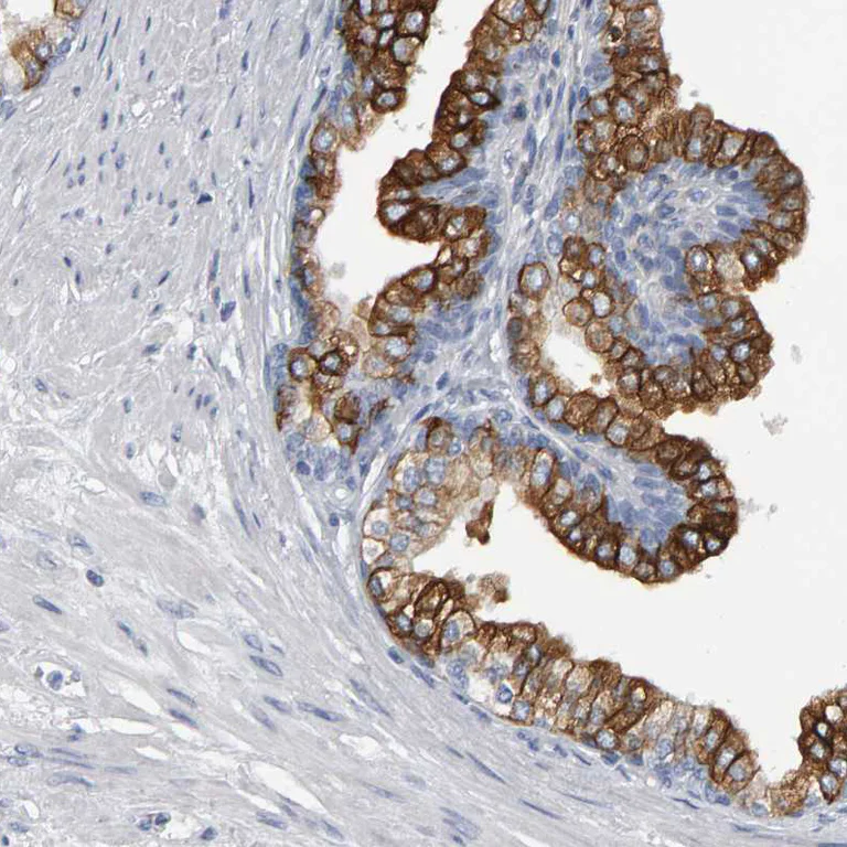 Immunohistochemistry (Formalin/PFA-fixed paraffin-embedded sections) - Anti-CD38 antibody (AB244390)