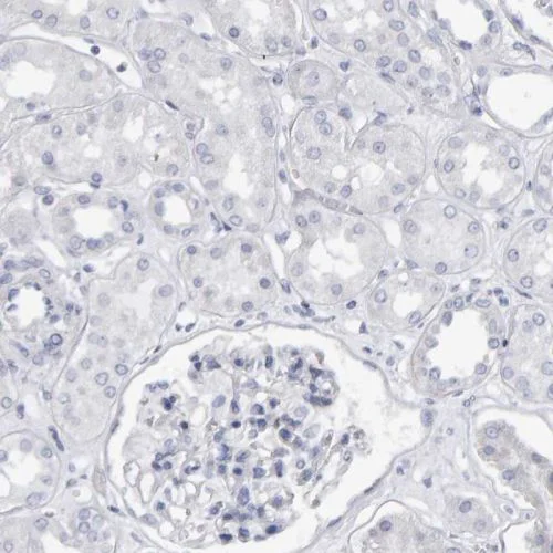 Immunohistochemistry (Formalin/PFA-fixed paraffin-embedded sections) - Anti-CD38 antibody (AB244390)