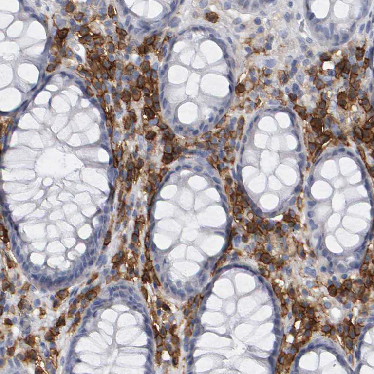 Immunohistochemistry (Formalin/PFA-fixed paraffin-embedded sections) - Anti-CD38 antibody (AB244390)