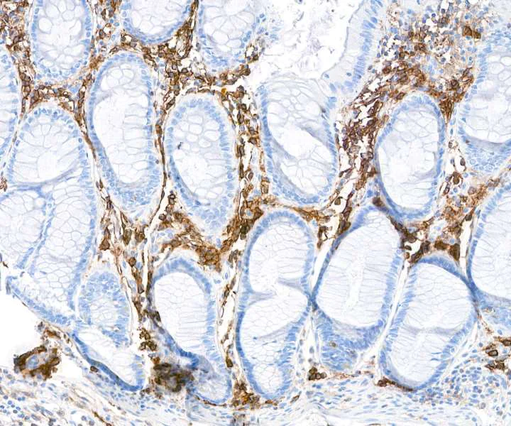 Immunohistochemistry (Formalin/PFA-fixed paraffin-embedded sections) - Anti-CD38 antibody [BLR123H] - BSA free (AB314061)