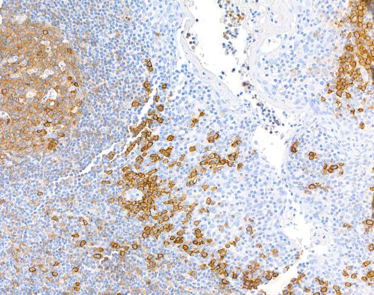 Immunohistochemistry (Formalin/PFA-fixed paraffin-embedded sections) - Anti-CD38 antibody [BLR123H] - BSA free (AB314061)
