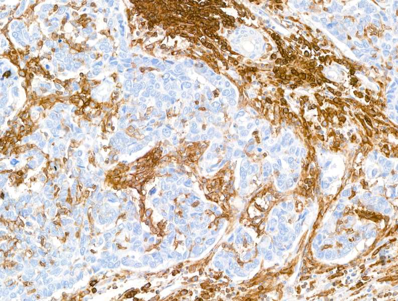 Immunohistochemistry (Formalin/PFA-fixed paraffin-embedded sections) - Anti-CD38 antibody [BLR123H] - BSA free (AB314061), expandable thumbnail