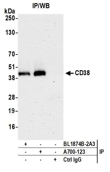 Immunoprecipitation - Anti-CD38 antibody [BLR123H] - BSA free (AB314061)