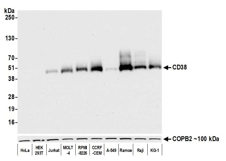 Western blot - Anti-CD38 antibody [BLR123H] - BSA free (AB314061)