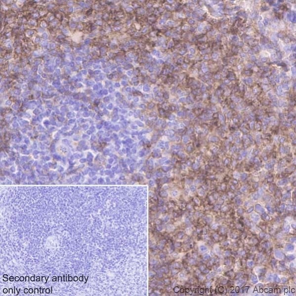Immunohistochemistry (Formalin/PFA-fixed paraffin-embedded sections) - Anti-CD38 antibody [EPR21079] - BSA and Azide free (AB230153), expandable thumbnail