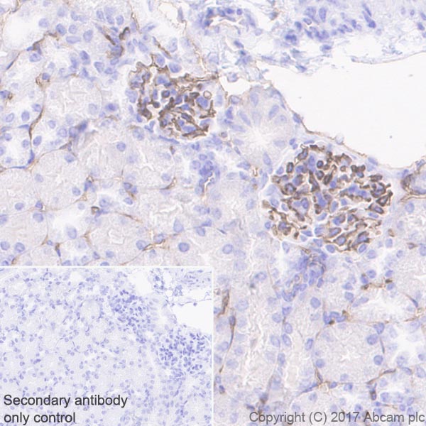 Immunohistochemistry (Formalin/PFA-fixed paraffin-embedded sections) - Anti-CD38 antibody [EPR21079] - BSA and Azide free (AB230153), expandable thumbnail