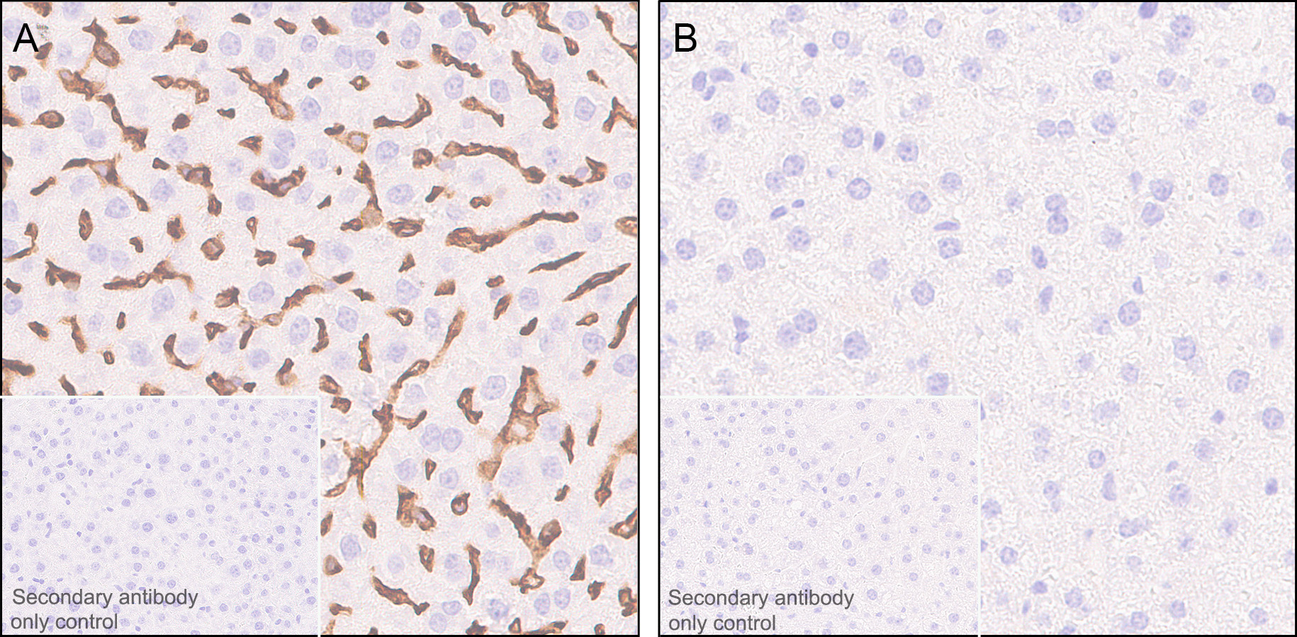 Immunohistochemistry (Formalin/PFA-fixed paraffin-embedded sections) - Anti-CD38 antibody [EPR21079] - BSA and Azide free (ab230153), expandable thumbnail