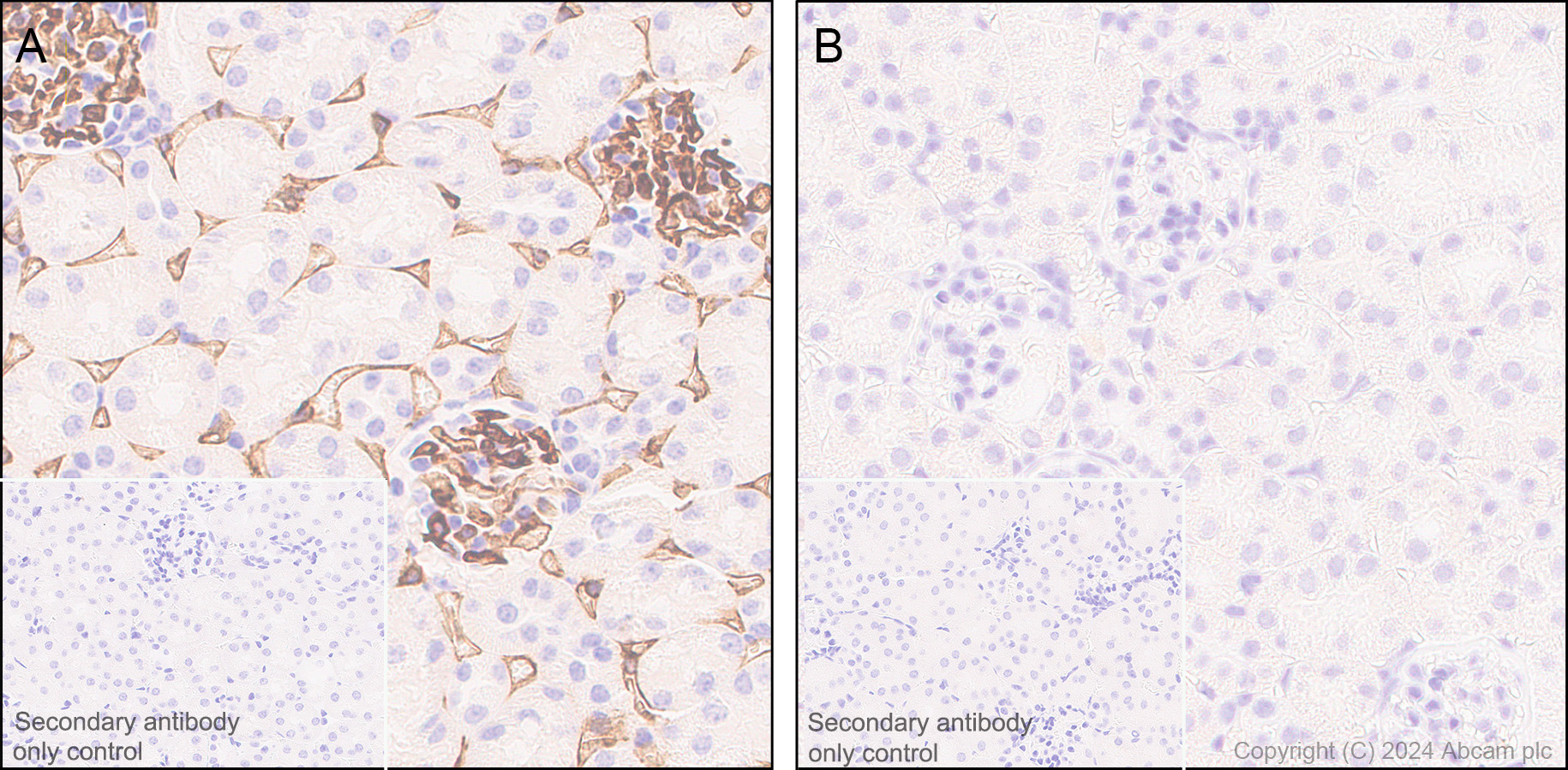 Immunohistochemistry (Formalin/PFA-fixed paraffin-embedded sections) - Anti-CD38 antibody [EPR21079] - BSA and Azide free (ab230153), expandable thumbnail