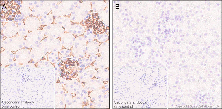 Immunohistochemistry (Formalin/PFA-fixed paraffin-embedded sections) - Anti-CD38 antibody [EPR21079] - BSA and Azide free (AB230153)