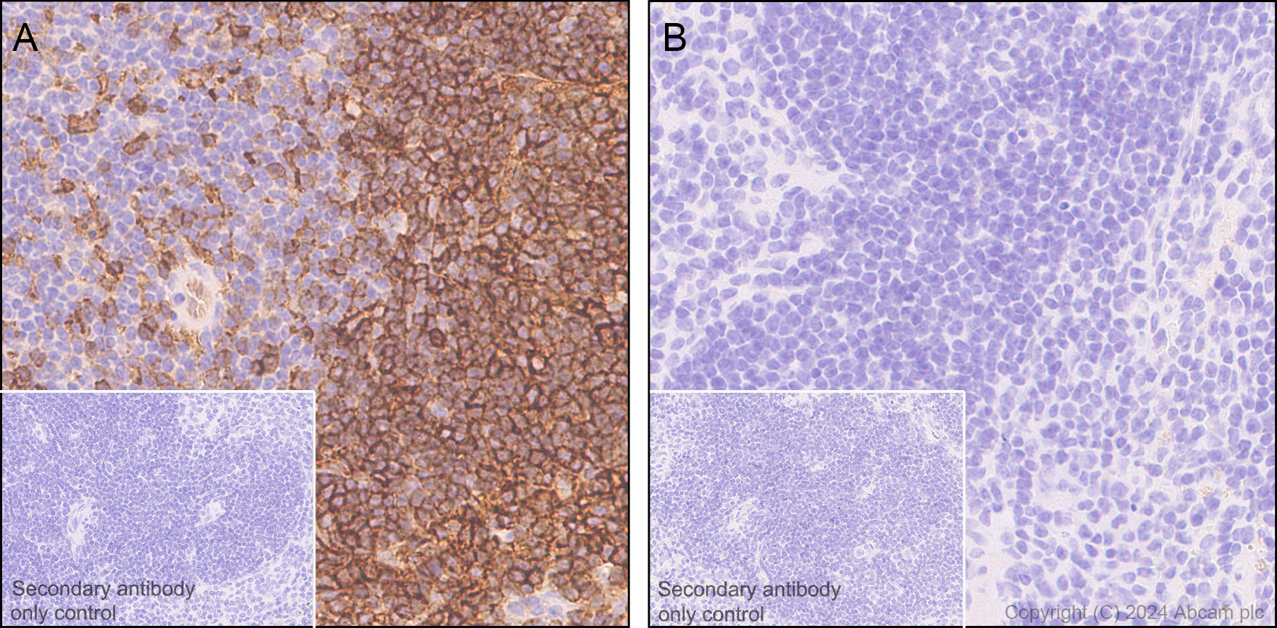 Immunohistochemistry (Formalin/PFA-fixed paraffin-embedded sections) - Anti-CD38 antibody [EPR21079] - BSA and Azide free (AB230153), expandable thumbnail