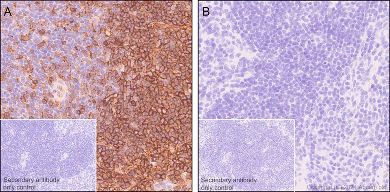 Immunohistochemistry (Formalin/PFA-fixed paraffin-embedded sections) - Anti-CD38 antibody [EPR21079] - BSA and Azide free (AB230153)