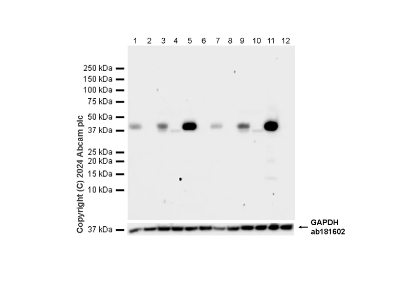 Western blot - Anti-CD38 antibody [EPR21079] - BSA and Azide free (AB230153)