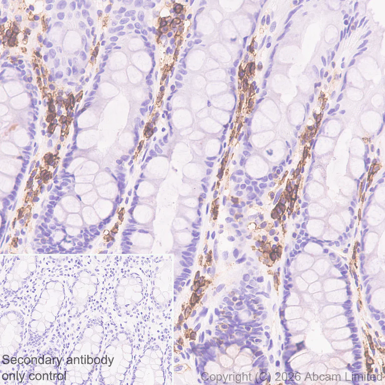 Immunohistochemistry (Formalin/PFA-fixed paraffin-embedded sections) - Anti-CD38 antibody [EPR31124-571] (AB326878)