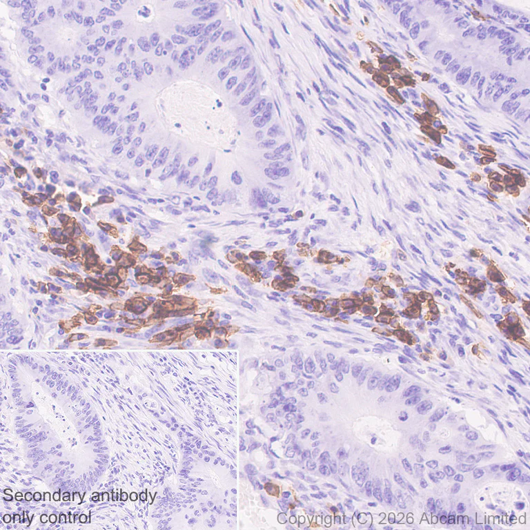 Immunohistochemistry (Formalin/PFA-fixed paraffin-embedded sections) - Anti-CD38 antibody [EPR31124-571] (AB326878)