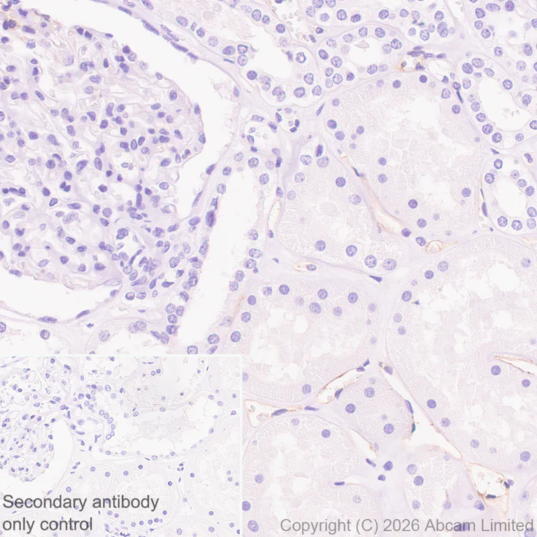 Immunohistochemistry (Formalin/PFA-fixed paraffin-embedded sections) - Anti-CD38 antibody [EPR31124-571] (AB326878)