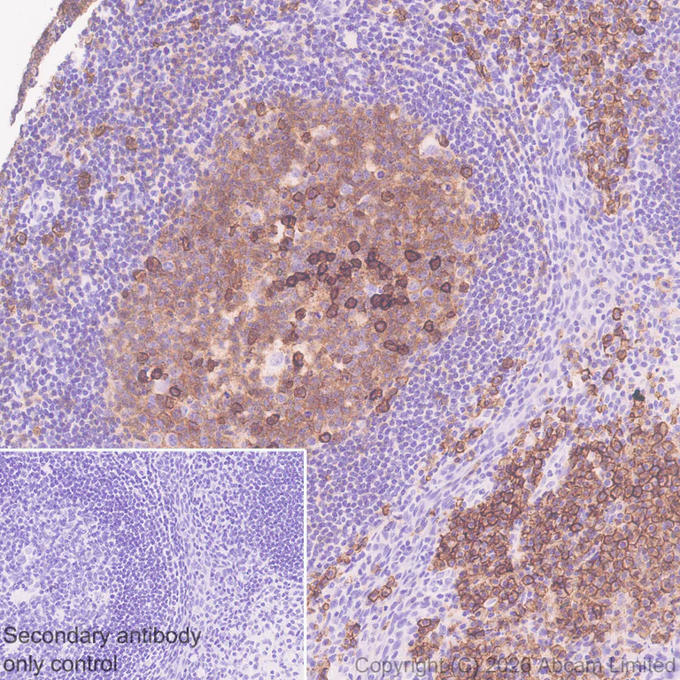 Immunohistochemistry (Formalin/PFA-fixed paraffin-embedded sections) - Anti-CD38 antibody [EPR31124-571] - BSA and Azide free (AB326885)