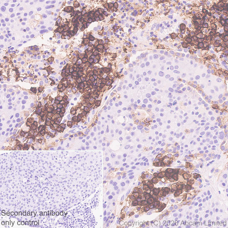 Immunohistochemistry (Formalin/PFA-fixed paraffin-embedded sections) - Anti-CD38 antibody [EPR31124-571] - BSA and Azide free (AB326885)