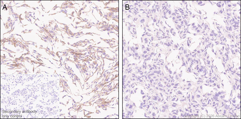 Immunohistochemistry (Formalin/PFA-fixed paraffin-embedded sections) - Anti-CD38 antibody [EPR31124-571] - BSA and Azide free (AB326885)