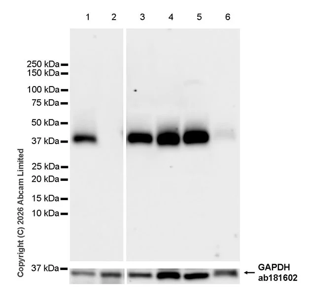 Western blot - Anti-CD38 antibody [EPR31124-571] - BSA and Azide free (AB326885)