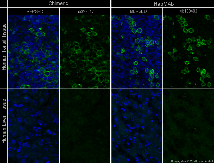 Immunohistochemistry (Formalin/PFA-fixed paraffin-embedded sections) - Anti-CD38 antibody [EPR4106] (AB108403)