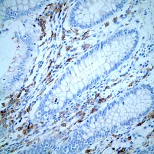 Immunohistochemistry (Formalin/PFA-fixed paraffin-embedded sections) - Anti-CD38 antibody [EPR4106] - BSA and Azide free (ab226034), expandable thumbnail