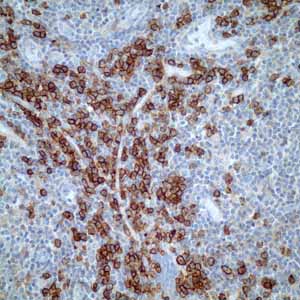 Immunohistochemistry (Formalin/PFA-fixed paraffin-embedded sections) - Anti-CD38 antibody [EPR4106] - BSA and Azide free (AB226034), expandable thumbnail