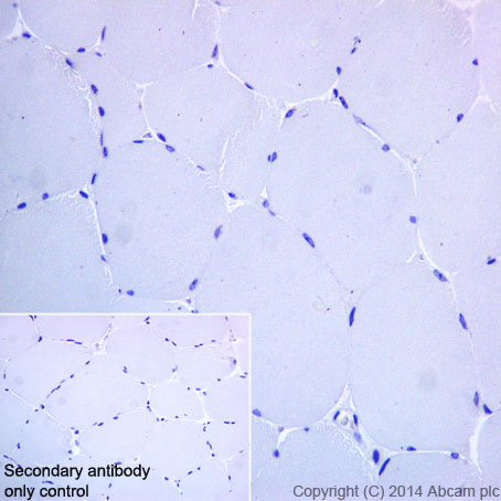 Immunohistochemistry (Formalin/PFA-fixed paraffin-embedded sections) - Anti-CD38 antibody [EPR4106] - BSA and Azide free (AB226034), expandable thumbnail