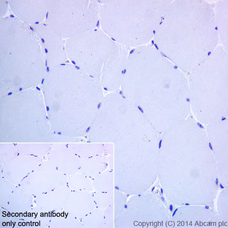 Immunohistochemistry (Formalin/PFA-fixed paraffin-embedded sections) - Anti-CD38 antibody [EPR4106] - BSA and Azide free (AB226034)
