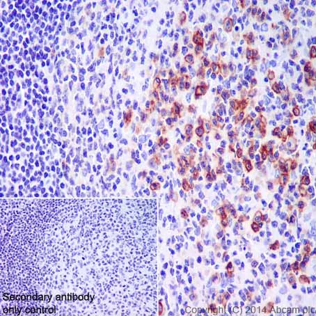 Immunohistochemistry (Formalin/PFA-fixed paraffin-embedded sections) - Anti-CD38 antibody [EPR4106] - BSA and Azide free (AB226034)