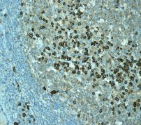 Anti-CD38 antibody [EPR4106] - BSA and Azide free (ab226034