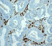 Immunohistochemistry (Formalin/PFA-fixed paraffin-embedded sections) - Anti-CD38 antibody [EPR4106] - BSA and Azide free (AB226034)