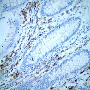 Immunohistochemistry (Formalin/PFA-fixed paraffin-embedded sections) - Anti-CD38 antibody [EPR4106] - Low endotoxin, Azide free (AB176886)