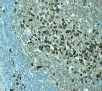 Immunohistochemistry (Formalin/PFA-fixed paraffin-embedded sections) - Anti-CD38 antibody [EPR4106] - Low endotoxin, Azide free (AB176886)