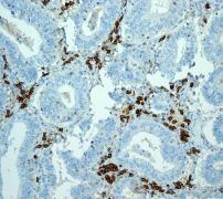 Immunohistochemistry (Formalin/PFA-fixed paraffin-embedded sections) - Anti-CD38 antibody [EPR4106] - Low endotoxin, Azide free (AB176886)
