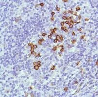 Immunohistochemistry (Formalin/PFA-fixed paraffin-embedded sections) - Anti-CD38 antibody [SP149] - BSA and Azide free (AB236232)