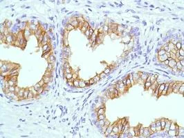 Immunohistochemistry (Formalin/PFA-fixed paraffin-embedded sections) - Anti-CD38 antibody [SP149] - BSA and Azide free (AB236232)