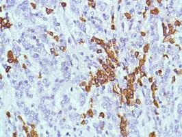 Immunohistochemistry (Formalin/PFA-fixed paraffin-embedded sections) - Anti-CD38 antibody [SP149] - BSA and Azide free (AB236232)