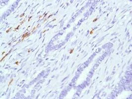Immunohistochemistry (Formalin/PFA-fixed paraffin-embedded sections) - Anti-CD38 antibody [SP149] - BSA and Azide free (AB236232)