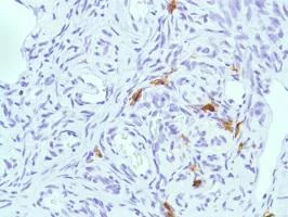 Immunohistochemistry (Formalin/PFA-fixed paraffin-embedded sections) - Anti-CD38 antibody [SP149] - BSA and Azide free (AB236232)
