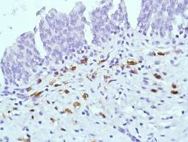 Immunohistochemistry (Formalin/PFA-fixed paraffin-embedded sections) - Anti-CD38 antibody [SP149] - BSA and Azide free (AB236232)