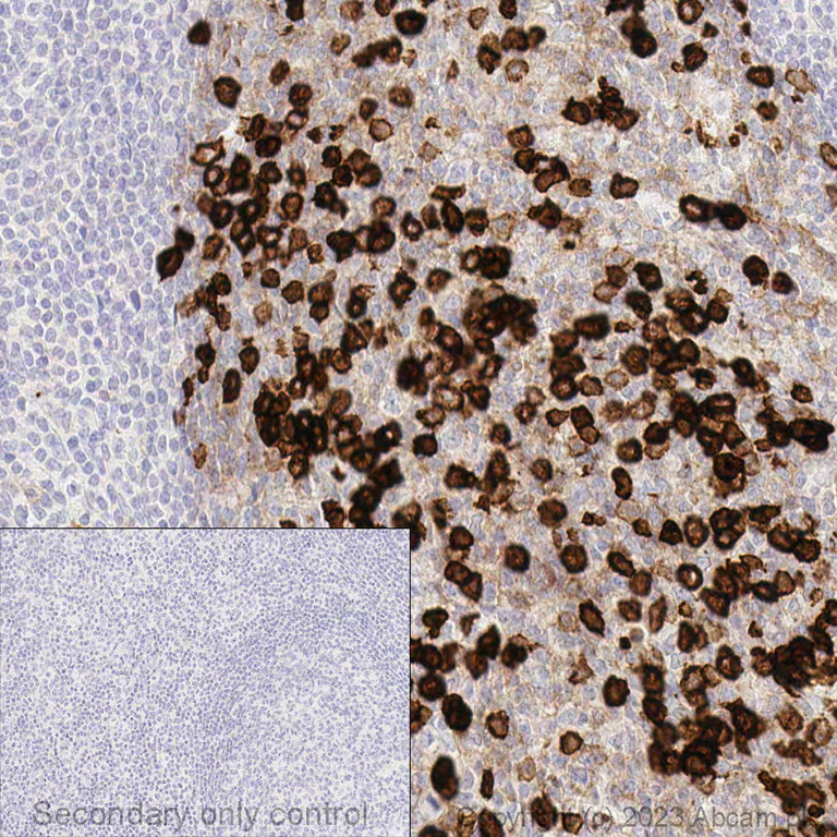 Immunohistochemistry (Formalin/PFA-fixed paraffin-embedded sections) - Anti-CD38 antibody [SP149] - BSA and Azide free (AB236232)