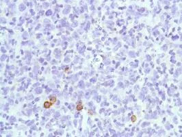 Immunohistochemistry (Formalin/PFA-fixed paraffin-embedded sections) - Anti-CD38 antibody [SP149] - BSA and Azide free (AB236232)