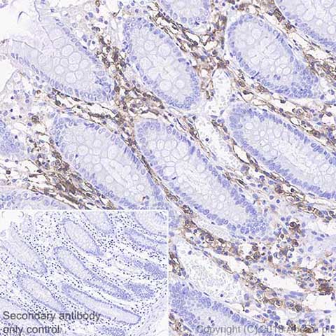 Immunohistochemistry (Formalin/PFA-fixed paraffin-embedded sections) - Anti-CD38 antibody [SP149] - BSA and Azide free (AB236232)