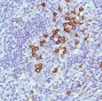 Immunohistochemistry (Formalin/PFA-fixed paraffin-embedded sections) - Anti-CD38 antibody [SP149] - C-terminal (ab183326), expandable thumbnail