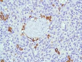Immunohistochemistry (Formalin/PFA-fixed paraffin-embedded sections) - Anti-CD38 antibody [SP149] - C-terminal (ab183326), expandable thumbnail